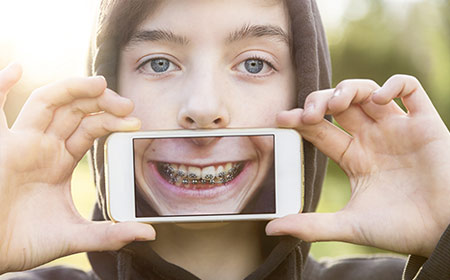 Orthodontic Assessment | Kedron Family Dental